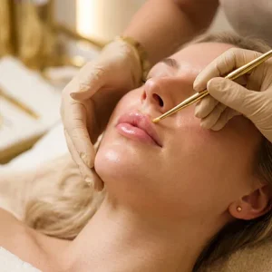 LIPPENLIFTING